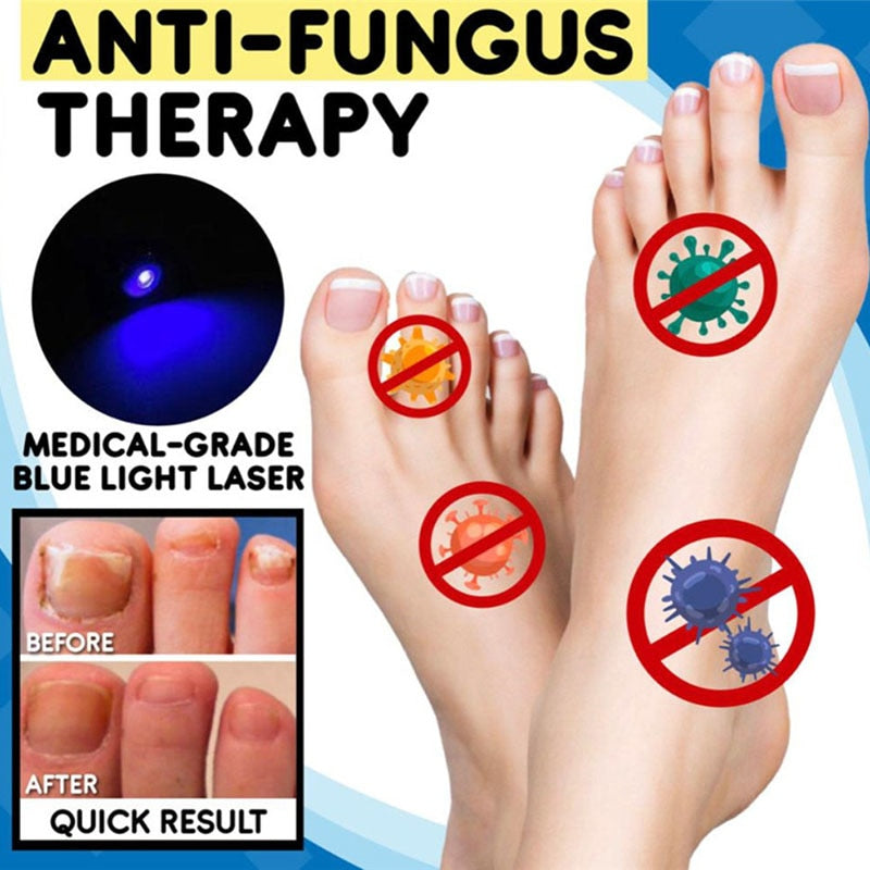 1 Pcs Anti-fungal Home Set Laser Pen Finger Toe Nail Fungus Care Kit